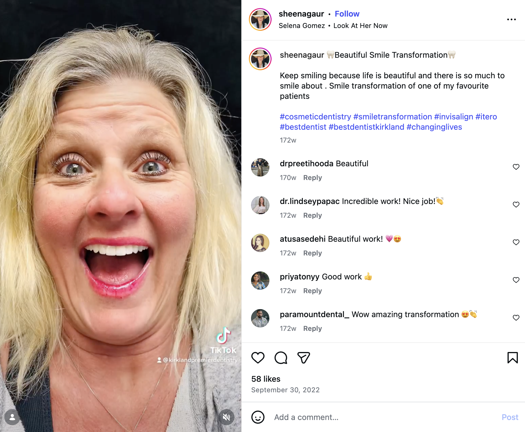 Instagram-style post showing a veneer smile transformation from Kirkland Premier Dentistry