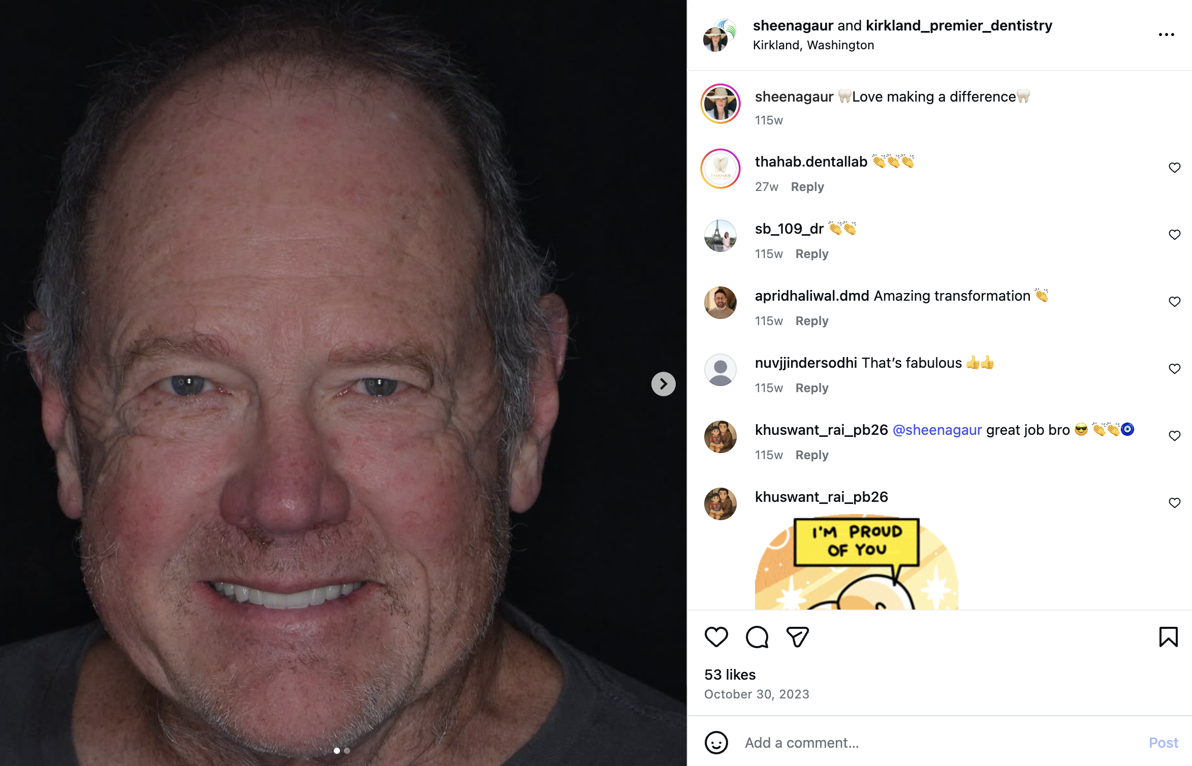 Instagram-style post showing veneer results posted by Kirkland Premier Dentistry