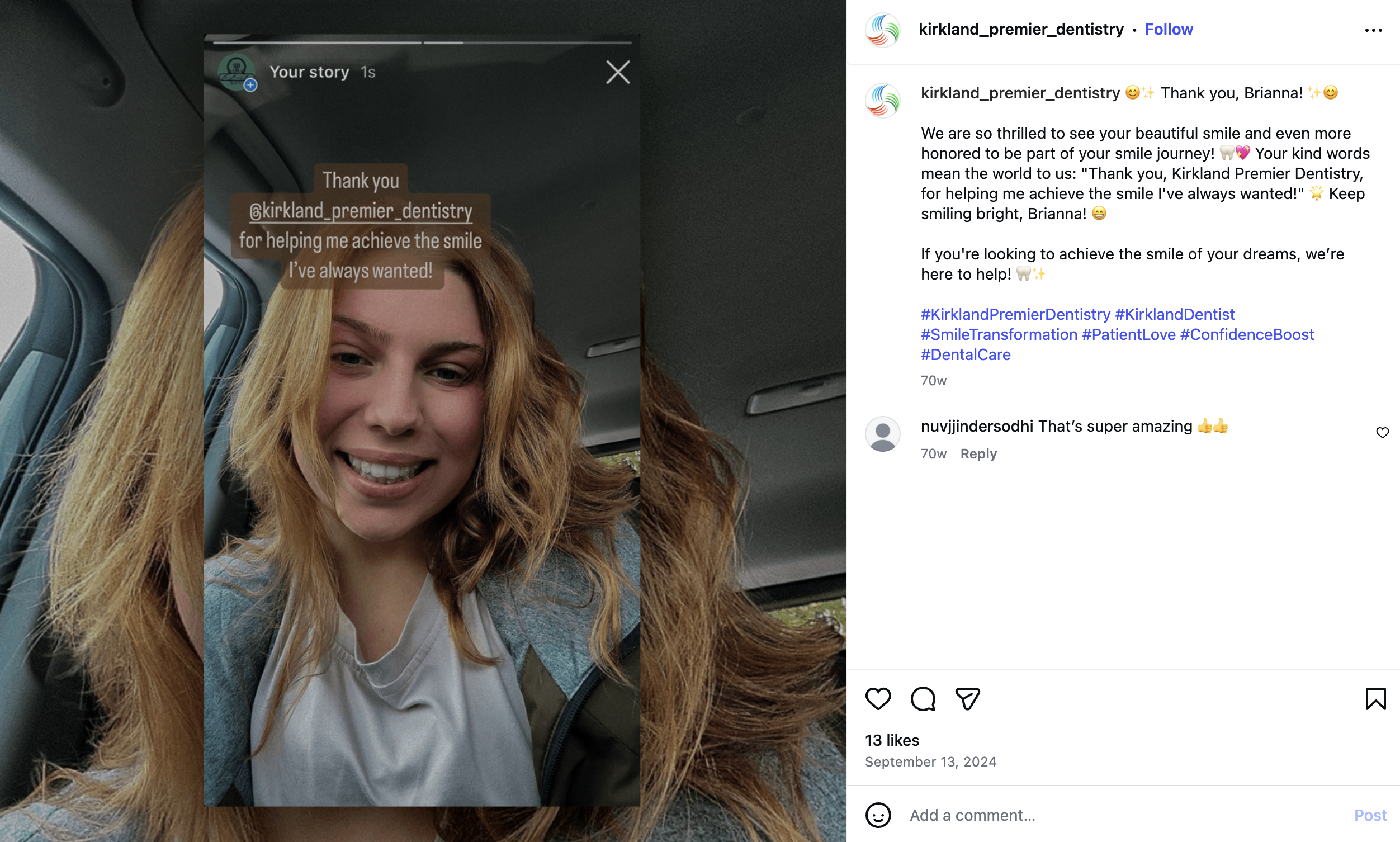 Invisalign progress post shared by Kirkland Premier Dentistry